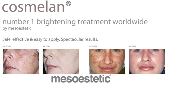 Cosmelan® Professional Treatment